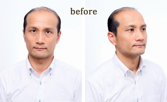 カツラ髪型スタイル007カジュアル スポーティー かつらウィズ ウィッグ専門店 With