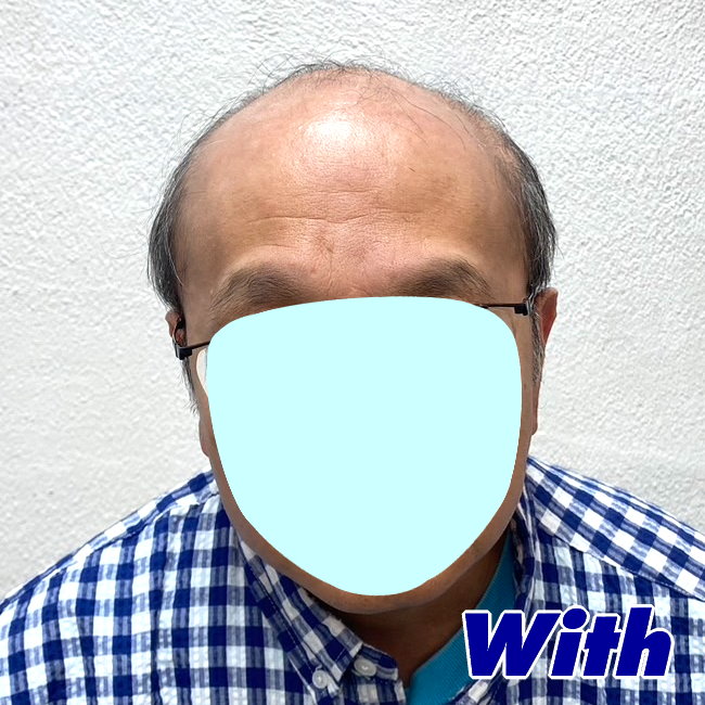 16a240316a_男性用かつらオーダーメイド装着前1