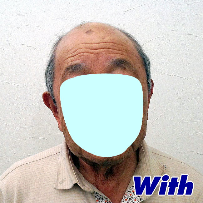 208240308a_男性用かつらオーダーメイド装着前1