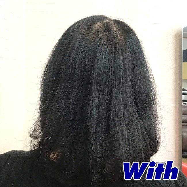 13a240328a_女性向け医療用ウィッグ着用前スタイル3
