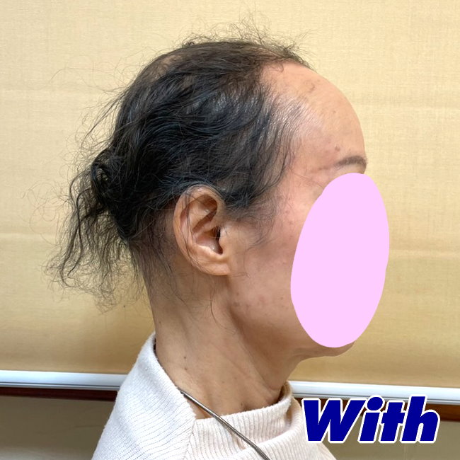 53a240402a_女性向けウィッグ着用前スタイル2