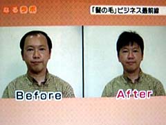 かつら使用前とカツラ使用後のモデルさん