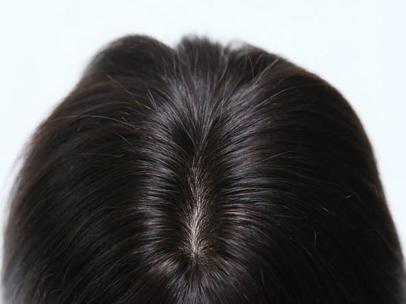 本物の皮膚と見分けがつかない