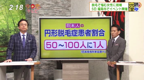 RKB毎日テレビ「今日感テレビ」で紹介されました｜2015年9月