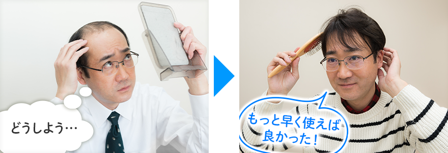 かつら(ウィッグ)もっと早く使えば良かった
