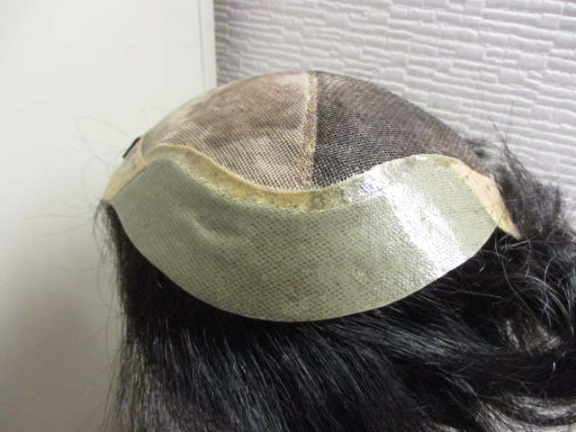傷んだスキン部分を取りかえる修理でキレイな仕上がりになりました。