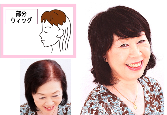 一部をカバーする部分かつら（パートウィッグ）女性