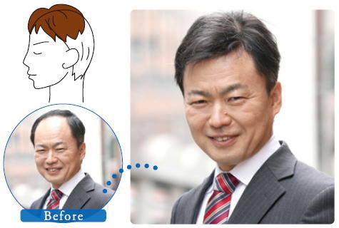 一部をカバーする部分かつら（パートウィッグ）男性