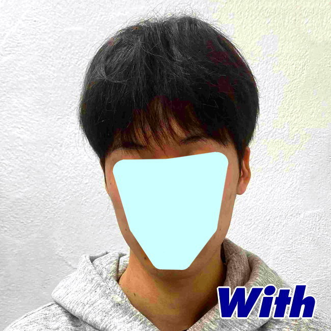 画像に alt 属性が指定されていません。ファイル名: 16a240131a_after1.jpg