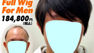 19a240323a_男性向け医療用かつら装着ビフォーアフター