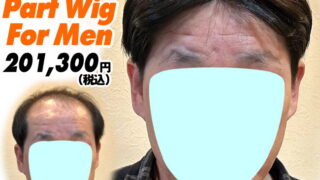 225240121a_男性用かつら装着ビフォーアフター
