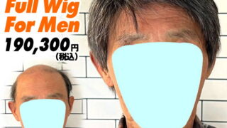 54a240326a_男性向け医療用かつら装着ビフォーアフター