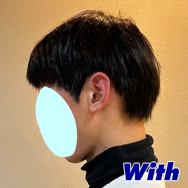 画像に alt 属性が指定されていません。ファイル名: 225240305a_after2.jpg