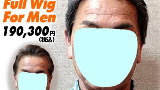 65a240423a_男性向け医療用かつら装着ビフォーアフター