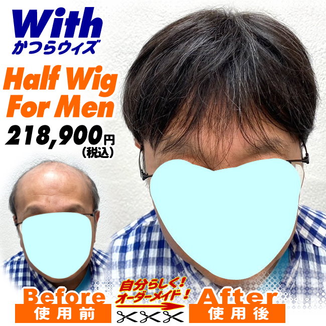 男性用かつら装着ビフォーアフター16a240316a