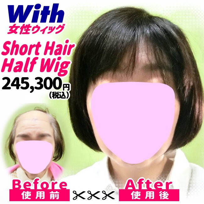 46a240208a_女性医療用ウィッグ着用ビフォーアフター