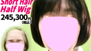 46a240208a_beforeafter-320x180.jpg