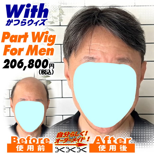 男性用かつら装着ビフォーアフター54a240226a