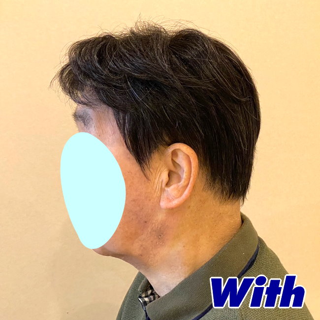 画像に alt 属性が指定されていません。ファイル名: 209240308a_after2.jpg