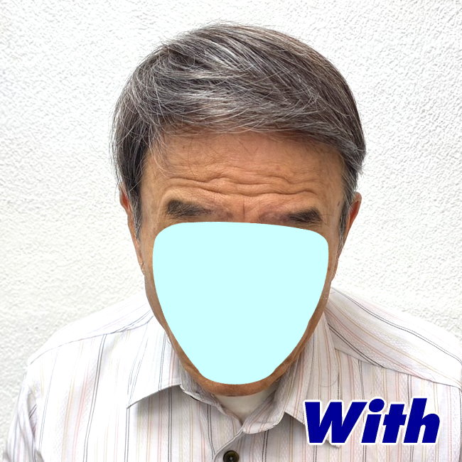 画像に alt 属性が指定されていません。ファイル名: 16a240307a_after1.jpg