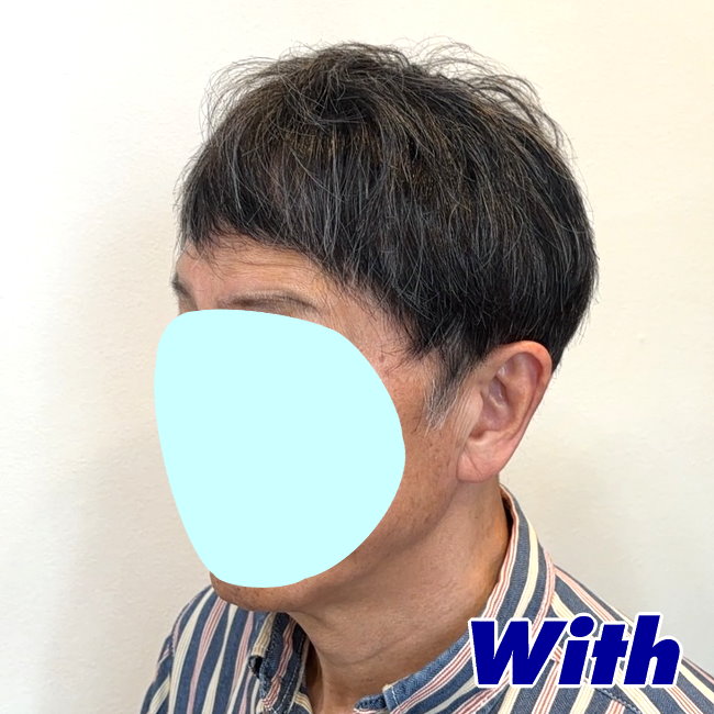 画像に alt 属性が指定されていません。ファイル名: 229240307a_after2.jpg