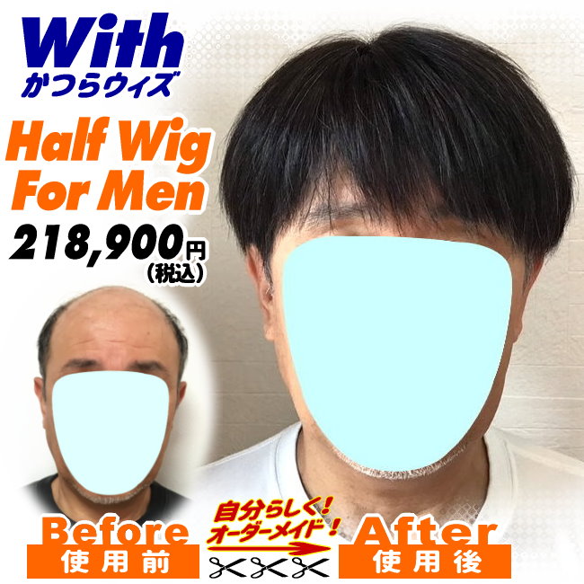 男性用かつら装着ビフォーアフター13a240324a