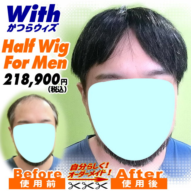 46a240319a_男性向け医療用かつら装着ビフォーアフター