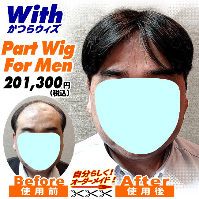 65a240409a_男性用かつら装着ビフォーアフター