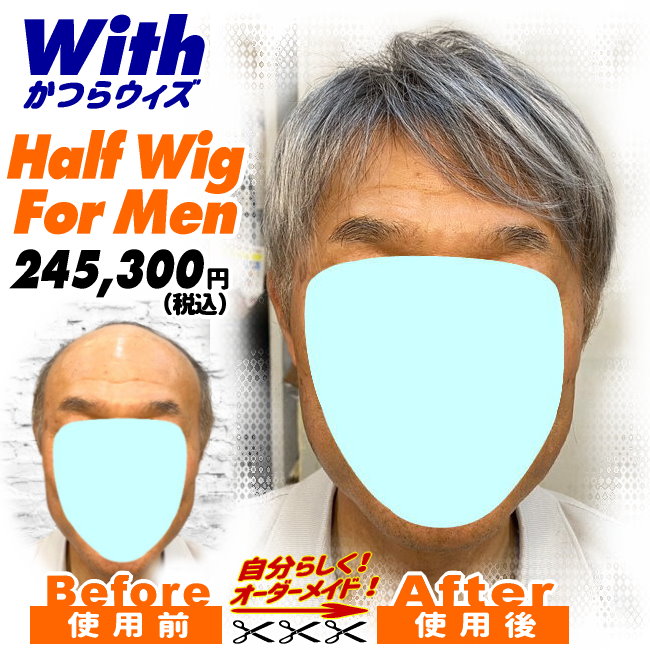 男性用かつら装着ビフォーアフター210240323a