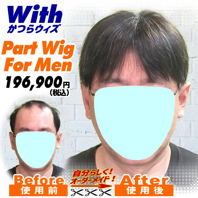 男性用かつら装着ビフォーアフター46a240503a
