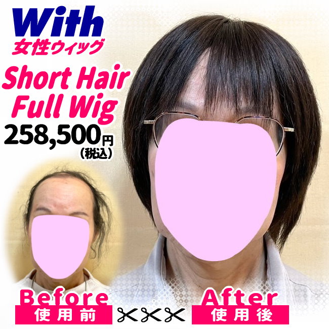 53a240402a_女性用ウィッグ着用ビフォーアフター