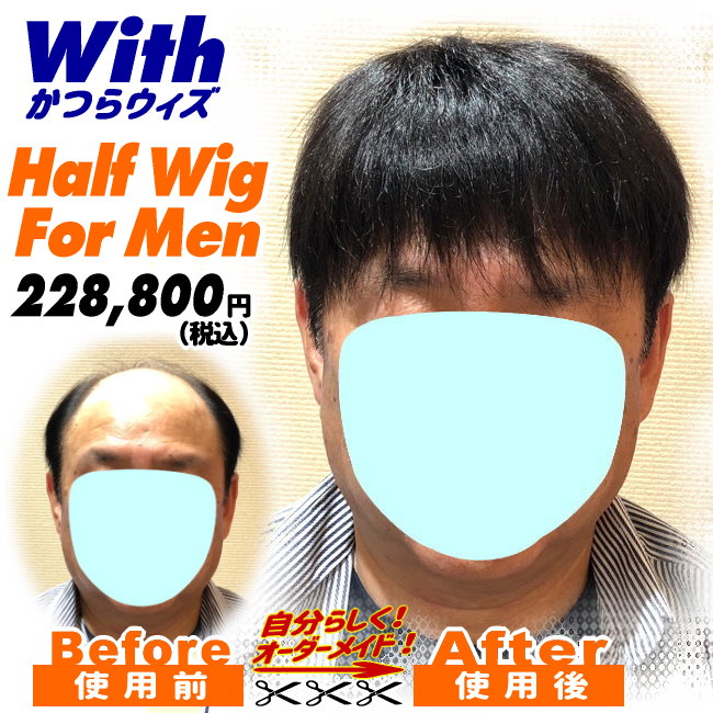 男性用かつら装着ビフォーアフター66a240327a