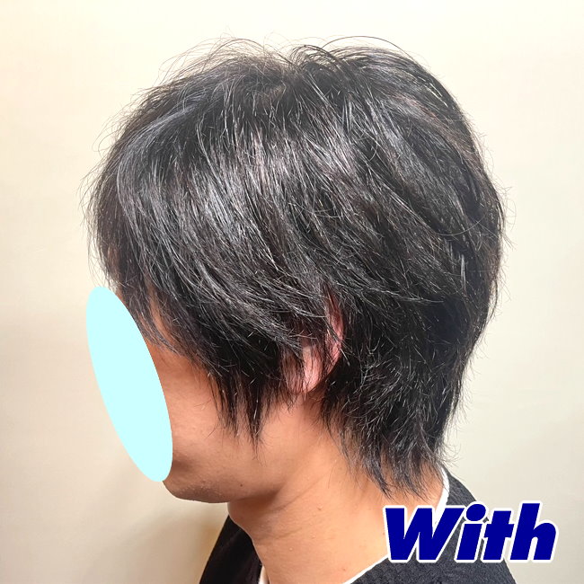 画像に alt 属性が指定されていません。ファイル名: 221240622a_after2.jpg