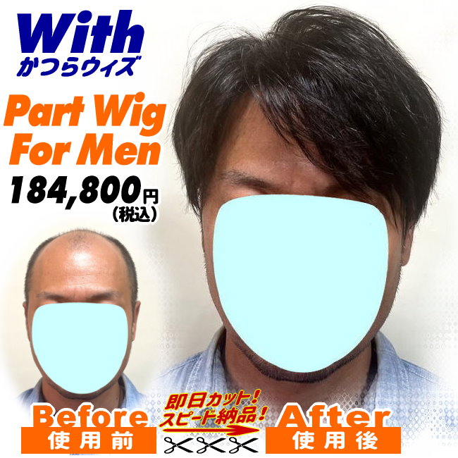 221240715a_男性用かつら装着ビフォーアフター