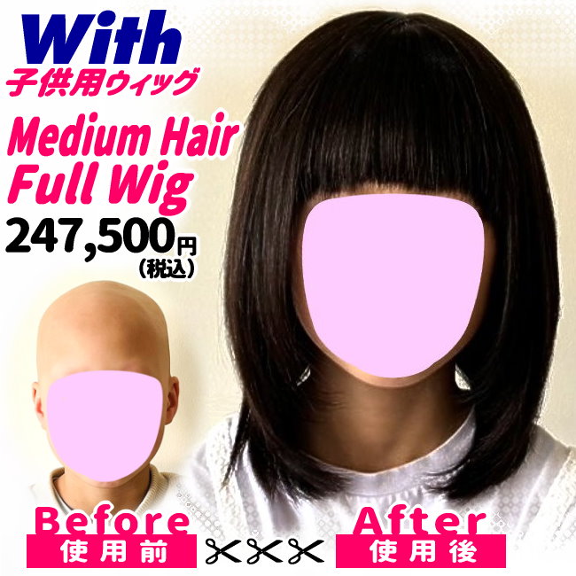 47a240210a_子供用医療ウィッグ着用ビフォーアフター
