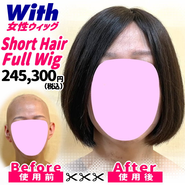 53a240517a_女性医療用ウィッグ着用ビフォーアフター