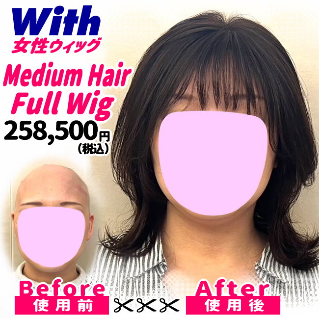 207240402a_女性医療用ウィッグ着用ビフォーアフター