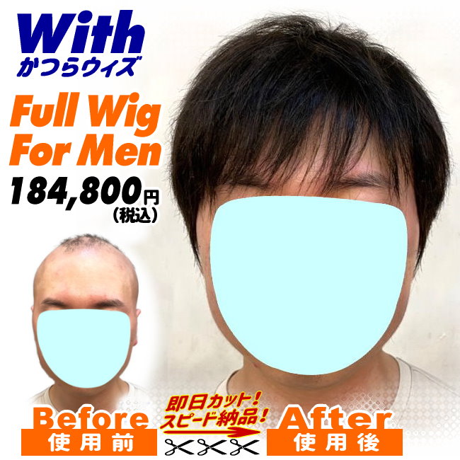 210240722a_男性向け医療用かつら装着ビフォーアフター