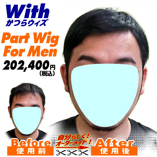 46a240512a_男性用かつら装着ビフォーアフター