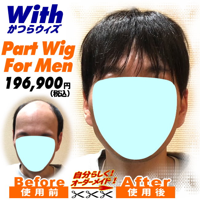 男性用かつら装着ビフォーアフター66a240608a