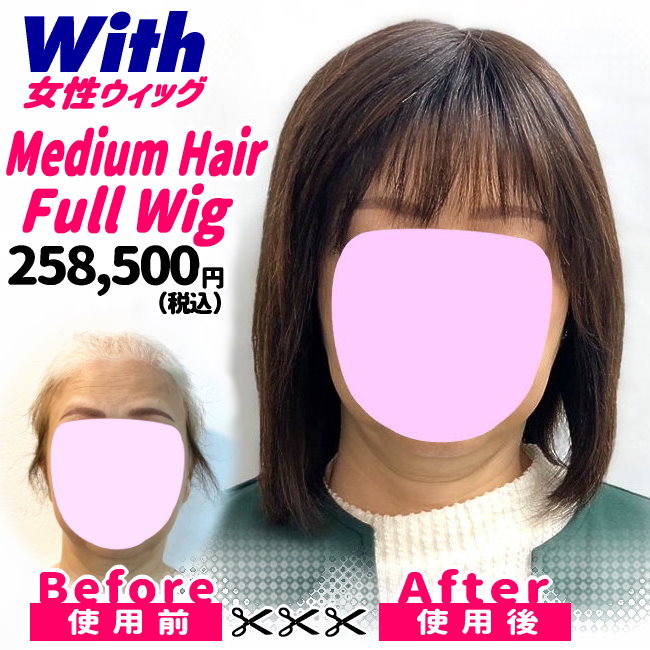 207240402a_女性医療用ウィッグ着用ビフォーアフター