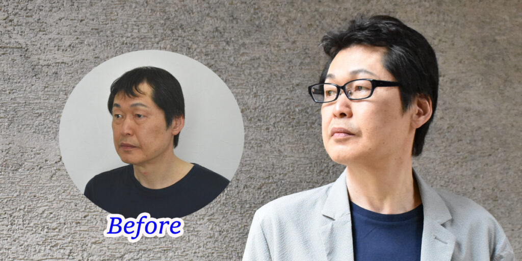 医療用男性かつら